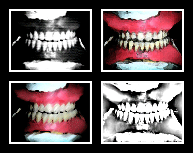 Teeth